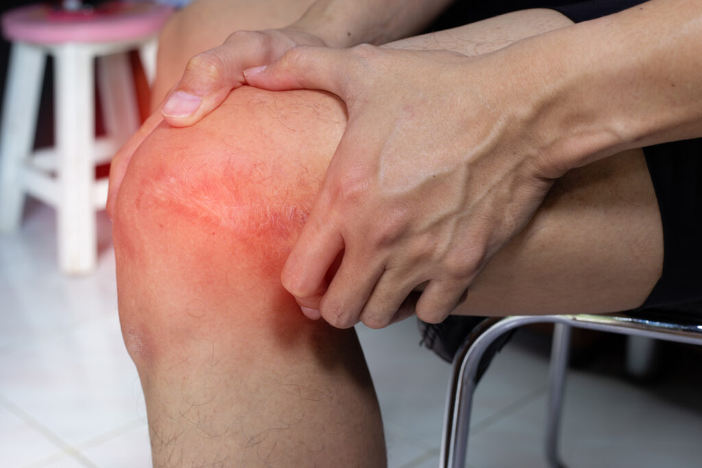 LEFT KNEE PAIN ICD 10 | CAUSES AND TREATMENTS